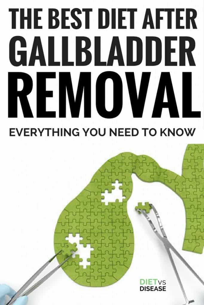 Diet after gallbladder removal pdf