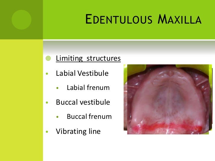 Diagnosis and treatment planning in complete denture pdf