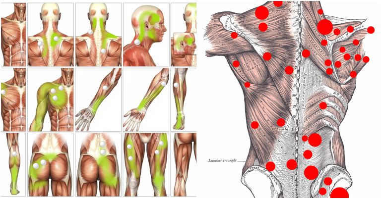 Trigger point release techniques pdf