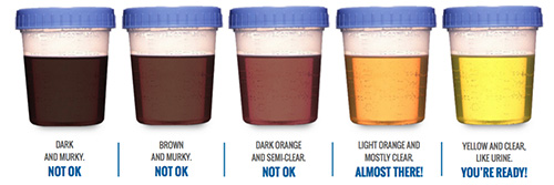 fasting instructions for colonoscopy