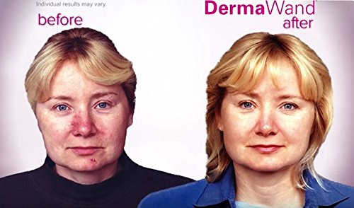 instructions for using dermawand