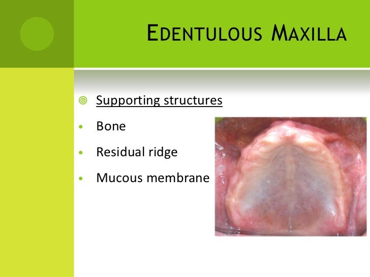 Diagnosis and treatment planning in complete denture pdf