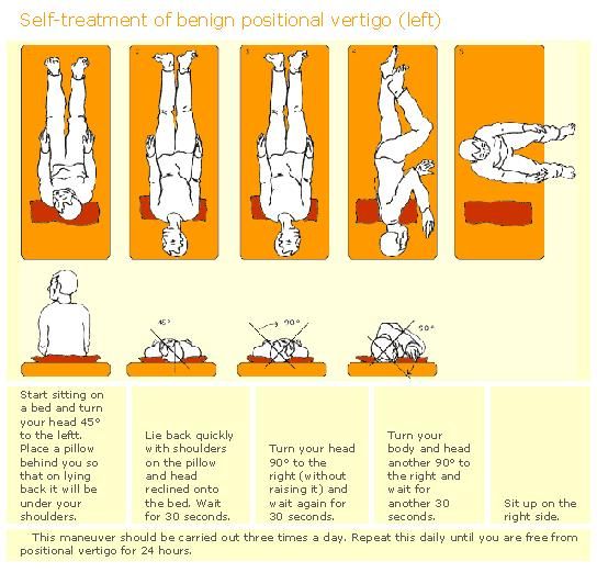 Epley maneuver instructions handout